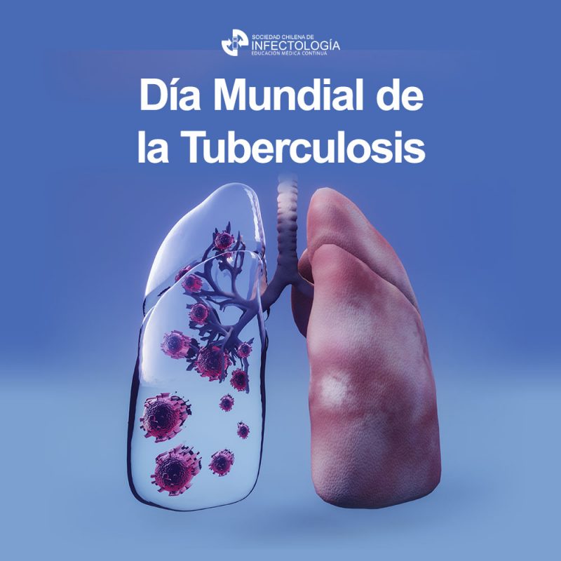 D A Mundial De La Tuberculosis SOCHINF   Sochinf Imagen Para RRSS 1 4 800x800 